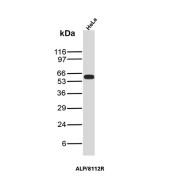 PLAP Antibody HeLa WB. Western blot analysis of HeLa cell lysate using PLAP Antibody / Placental Alkaline Phosphatase Antibody (clone ALP/8112R) detects a prominent band at approximately 63-66 kDa, consistent with placental alkaline phosphatase / ALPP. The observed molecular weight is higher than the predicted core protein size due to glycosylation and post-translational processing characteristic of this glycosylphosphatidylinositol-anchored alkaline phosphatase family member.