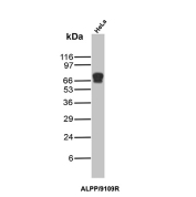ALPP Antibody HeLa WB. Western blot analysis of HeLa cell lysate using ALPP Antibody / Placental Alkaline Phosphatase Antibody (clone ALP/9109R) detects a strong band at approximately 68-72 kDa, consistent with placental alkaline phosphatase / ALPP. The observed molecular weight is higher than the predicted core protein size due to extensive glycosylation and post-translational modification commonly associated with this glycosylphosphatidylinositol-anchored alkaline phosphatase family member.