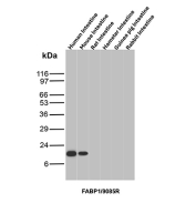 FABP1 Antibody Multi-Species Tissue WB. Western blot analysis of human, mouse, rat, hamster, guinea pig, and rabbit intestine tissue lysates using Fatty acid-binding protein 1 antibody clone FABP1/9085R. A band is detected at approximately 14 kDa in selected species, consistent with the predicted molecular weight of FABP1, an intestinal and hepatic lipid-binding protein involved in fatty acid transport and metabolism.