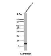 Fatty Acid Binding Protein 1 Antibody Rabbit MAb Human Intestine WB. Western blot analysis of human intestine tissue lysate using FABP1 antibody clone FABP1/9085R. A clear band is detected at approximately 14 kDa, consistent with the predicted molecular weight of Fatty acid-binding protein 1 / FABP1, an abundant cytoplasmic fatty acid transport protein expressed in intestinal epithelial cells.