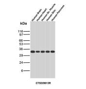 Cathepsin D Antibody Human Tissue Panel WB. Western blot analysis of human 1) brain, 2) heart, 3) skeletal muscle, 4) skin, and 5) pancreas tissue lysates using Cathepsin D Antibody (clone CTSD/9613R) detects a consistent band at approximately 30-35 kDa across all samples, corresponding to the processed mature form of Cathepsin D (CTSD). Cathepsin D is synthesized as a larger precursor that undergoes proteolytic cleavage to generate active heavy and light chain fragments, with the observed band reflecting the predominant mature species. The uniform banding pattern across tissues supports reliable detection of CTSD and is consistent with its widespread lysosomal expression.