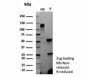 SDS-PAGE analysis of purified, BSA-free recombinant IVL antibody (clone rIVRN/9323) as confirmation of integrity and purity.