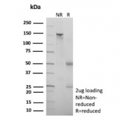 SDS-PAGE analysis of purified, BSA-free recombinant CD10 antibody (clone MME/9617R) as confirmation of integrity and purity.