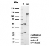 SDS-PAGE analysis of purified, BSA-free recombinant MME antibody (clone rMME/9377) as confirmation of integrity and purity.