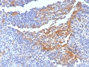 IHC staining of FFPE human tonsil tissue with CD14 antibody (clone LPSR/7738). HIER: boil tissue sections in pH 9 10mM Tris with 1mM EDTA for 20 min and allow to cool before testing.