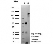 SDS-PAGE analysis of purified, BSA-free recombinant CD63 antibody (clone LAMP3/9191R) as confirmation of integrity and purity.