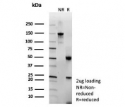 SDS-PAGE analysis of purified, BSA-free recombinant LAMP-3 antibody (clone rLAMP3/9131) as confirmation of integrity and purity.