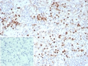 IHC staining of FFPE human spleen tissue with recombinant LAMP-3 antibody (clone rLAMP3/9131). Inset: PBS used in place of primary Ab (secondary Ab negative control). HIER: boil tissue sections in pH 9 10mM Tris with 1mM EDTA for 20 min and allow to cool before testing.