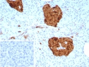 IHC staining of FFPE human pancreas tissue with Gamma Enolase antibody (clone ENO2/9046). Inset: PBS used in place of primary Ab (secondary Ab negative control). HIER: boil tissue sections in pH 9 10mM Tris with 1mM EDTA for 20 min and allow to cool before testing.