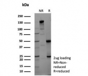 SDS-PAGE analysis of purified, BSA-free Gamma Enolase antibody (clone ENO2/9047) as confirmation of integrity and purity.