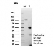 SDS-PAGE analysis of purified, BSA-free recombinant AR-V7 antibody (clone DHTR/9119R) as confirmation of integrity and purity.