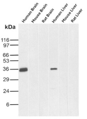 Apolipoprotein J Antibody Tissue WB. Western blot analysis of human brain, mouse brain, rat brain, human liver, mouse liver, and rat liver tissue lysates using Apolipoprotein J antibody. The recombinant rabbit monoclonal antibody clone CLU/9192R detects a band at approximately 36-39 kDa, consistent with the predicted molecular weight of the processed alpha and beta subunits of Clusterin / APO-J. Stronger signal in brain samples compared to liver aligns with the known enrichment of this secreted chaperone protein in neural and immune-associated tissue environments, while cross-species detection supports its conserved role in extracellular protein regulation.
