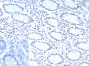IHC staining of FFPE human colon tissue with CDK4 antibody (clone CDK4/8895). Inset: PBS used in place of primary Ab (secondary Ab negative control). HIER: boil tissue sections in pH 9 10mM Tris with 1mM EDTA for 20 min and allow to cool before testing.