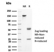 SDS-PAGE analysis of purified, BSA-free CK-BB antibody (clone CKBB/6871) as confirmation of integrity and purity.