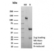 SDS-PAGE analysis of purified, BSA-free recombinant Creatine kinase B antibody (clone CKBB/8306R) as confirmation of integrity and purity.