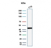 Western blot testing of human Y79 cell lysate using recombinant Creatine kinase B antibody (clone CKBB/8306). Predicted molecular weight ~43 kDa.