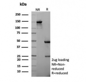 SDS-PAGE analysis of purified, BSA-free recombinant Cadherin 1 antibody (rCDH1/6769) as confirmation of integrity and purity.