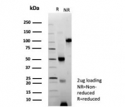 SDS-PAGE analysis of purified, BSA-free recombinant CD56 antibody (clone NCAM1/9121R) as confirmation of integrity and purity.