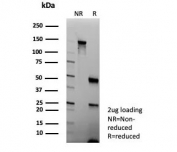 SDS-PAGE analysis of purified KRT5/6 antibody (clone KRT5.6/9104) as confirmation of integrity and purity.