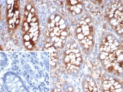IHC staining of FFPE human colon tissue with Carcinoembryonic antigen-related cell adhesion molecule 1 antibody (clone CEACAM1/4837). Inset: PBS used in place of primary Ab (secondary Ab negative control). HIER: boil tissue sections in pH 9 10mM Tris with 1mM EDTA for 20 min and allow to cool before testing.