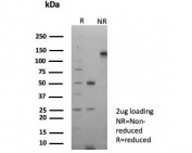 SDS-PAGE analysis of purified, BSA-free recombinant GFAP antibody (clone rGFAP/9150) as confirmation of integrity and purity.