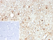IHC staining of FFPE human brain tissue with recombinant GFAP antibody (clone rGFAP/9150). Inset: PBS used in place of primary Ab (secondary Ab negative control). HIER: boil tissue sections in pH 9 10mM Tris with 1mM EDTA for 20 min and allow to cool before testing.