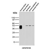 GFAP Antibody Brain Tissue WB. Western blot analysis of human brain, mouse brain, rat brain, guinea pig brain, and hamster brain tissue lysates using recombinant GFAP Antibody clone rGFAP/9150. A strong band is detected at approximately 50 kDa in human brain lysate, with corresponding bands also observed in rat, guinea pig, and hamster brain samples, consistent with the predicted molecular weight of Glial fibrillary acidic protein / GFAP, a major astrocytic intermediate filament protein involved in maintenance of neural cytoskeletal architecture and central nervous system integrity. Minor lower molecular weight bands beneath the primary human brain signal likely represent GFAP isoforms and/or partial proteolytic processing products commonly observed in neural tissue lysates.