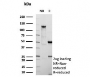 SDS-PAGE analysis of purified, BSA-free Fatty Acid Binding Protein 4 antibody (clone FABP4/9086R) as confirmation of integrity and purity.