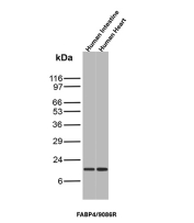 Fatty Acid Binding Protein 4 Antibody Multi-Tissue WB. Western blot analysis of human intestine and human heart tissue lysates using Fatty Acid Binding Protein 4 antibody clone FABP4/9086R. A prominent band is detected near 14-15 kDa, consistent with the expected molecular weight range of FABP4. The observed expression pattern supports the cytoplasmic role of FABP4 in intracellular fatty acid transport, lipid metabolism signaling, and adipocyte-associated metabolic regulation pathways across metabolically active human tissues.