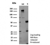 SDS-PAGE analysis of purified, BSA-free Pancreatic lipase antibody (clone PNLIP/9039) as confirmation of integrity and purity.