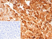 IHC staining of FFPE human pancreas tissue with Pancreatic lipase antibody (clone PNLIP/9041). Inset: PBS used in place of primary Ab (secondary Ab negative control). HIER: boil tissue sections in pH 9 10mM Tris with 1mM EDTA for 20 min and allow to cool before testing.