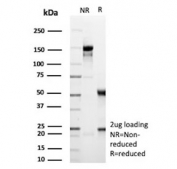 SDS-PAGE analysis of purified, BSA-free recombinant CR2 antibody (clone rCR2/9537) as confirmation of integrity and purity.