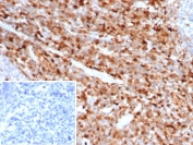 IHC staining of FFPE human tonsil tissue with S100A4 antibody (clone S100A4/6799). Inset: PBS used in place of primary Ab (secondary Ab negative control). HIER: boil tissue sections in pH 9 10mM Tris with 1mM EDTA for 20 min and allow to cool before testing.