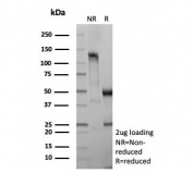 SDS-PAGE analysis of purified, BSA-free recombinant IL3RA antibody (clone rIL3RA/9212) as confirmation of integrity and purity.