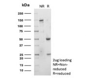 SDS-PAGE analysis of purified, BSA-free recombinant Carbamoyl phosphate synthetase 1 antibody (clone CPS1/9151R) as confirmation of integrity and purity.