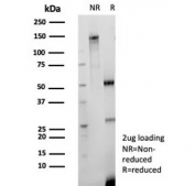 SDS-PAGE Analysis recombinant CD147 antibody (clone BSG/9223R) as confirmation of integrity and purity.