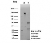 SDS-PAGE analysis of purified, BSA-free BRCA1 antibody (clone BRCA1/2973) as confirmation of integrity and purity.