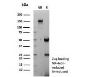 SDS-PAGE analysis of purified, BSA-free TTF-1 antibody (clone NX2.1/9035) as confirmation of integrity and purity.