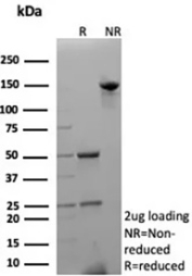 SDS-PAGE analysis of purified, BSA-free recombinant p27 antibody (clone KIP1/9168R) as confirmation of integrity and purity.