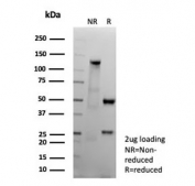 SDS-PAGE analysis of purified, BSA-free recombinant CD151 antibody (clone CD151/9297R) as confirmation of integrity and purity.