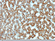 EPH Receptor B4 Antibody Liver IHC. Immunohistochemistry staining of FFPE human liver tissue with EPH Receptor B4 antibody (clone EPHB4/9663R). HIER: boil tissue sections in pH 9 10mM Tris with 1mM EDTA for 20 min and allow to cool before testing.