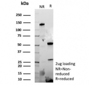 SDS-PAGE analysis of purified, BSA-free recombinant EPH Receptor B4 antibody (clone EPHB4/9663R) as confirmation of integrity and purity.