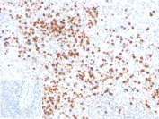IHC staining of FFPE human spleen tissue with Lysozyme antibody (clone LYZ/3941). Inset: PBS used in place of primary Ab (secondary Ab negative control). HIER: boil tissue sections in pH 9 10mM Tris with 1mM EDTA for 20 min and allow to cool before testing.