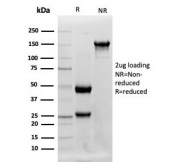 SDS-PAGE analysis of purified Lysozyme antibody (clone LYZ/3941) as confirmation of integrity and purity.