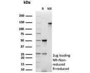 SDS-PAGE analysis of purified, BSA-free MDM2 antibody (clone MDM2/7943) as confirmation of integrity and purity.