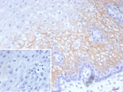 Desmocollin-2/3 Antibody Esophagus IHC. Immunohistochemistry analysis of FFPE human esophagus tissue stained with a recombinant monoclonal Desmocollin-2/3 antibody detecting DSC2 and DSC3, clone DSC2/9165R. Strong membranous staining is observed in stratified squamous epithelial cells, highlighting desmosomal junctions that mediate robust cell-cell adhesion and preserve epithelial structural integrity. Signal is most prominent along cell borders within basal and suprabasal layers, consistent with the role of desmocollins as core adhesion molecules in stratified epithelia, while surrounding stromal regions remain largely negative. The inset shows a PBS-only negative control processed without primary antibody, confirming minimal non-specific background staining. Hematoxylin counterstain highlights nuclei in blue. HIER: boil tissue sections in pH 9 10 mM Tris with 1 mM EDTA for 20 min and allow to cool before testing.
