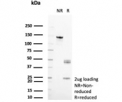 SDS-PAGE analysis of purified, BSA-free ARK1C1 antibody (clone AKR1C1/9062) as confirmation of integrity and purity.
