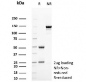SDS-PAGE analysis of purified, BSA-free ARK1C1 antibody (clone AKR1C1/9063) as confirmation of integrity and purity.