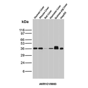 AKR1C1 Antibody Multi-Species Liver WB. Western blot analysis of (1) human liver, (2) mouse liver, (3) rat liver, (4) hamster liver, (5) guinea pig liver, and (6) HepG2 cell lysates using AKR1C1 Antibody (clone AKR1C1/9063) detects a band at approximately 37 kDa, consistent with the predicted molecular weight of AKR1C1 / Aldo-keto reductase family 1 member C1. Band intensity varies across species, with stronger signal observed in guinea pig liver and HepG2 cells, reflecting differences in expression level or antibody affinity. The overall pattern supports detection of AKR1C1 in hepatic tissues and liver-derived cell models involved in steroid metabolism and detoxification pathways.