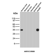 AKR1C1 Antibody Selective Reactivity Liver WB. Western blot analysis of (1) human liver, (2) mouse liver, (3) rat liver, (4) hamster liver, (5) guinea pig liver, and (6) HepG2 cell lysates using AKR1C1 Antibody (clone AKR1C1/9069) detects a band at approximately 37 kDa in human liver and HepG2 samples, consistent with the predicted molecular weight of AKR1C1 / Aldo-keto reductase family 1 member C1. Signal is not observed in the other species tested, indicating selective species reactivity for this clone. This pattern supports targeted detection of AKR1C1 in human-derived samples and highlights differences in cross-species recognition.